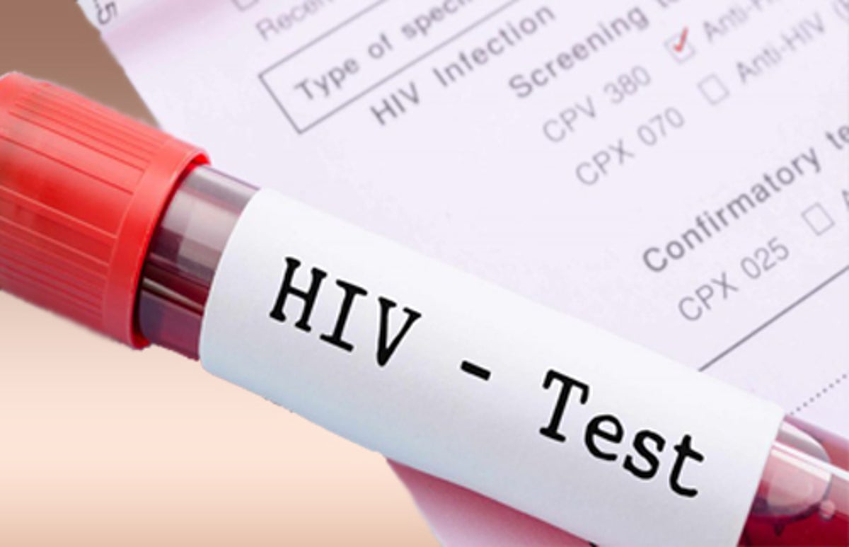 HIV-Test